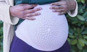 Secret saviour for stretch marks - Nursery Today